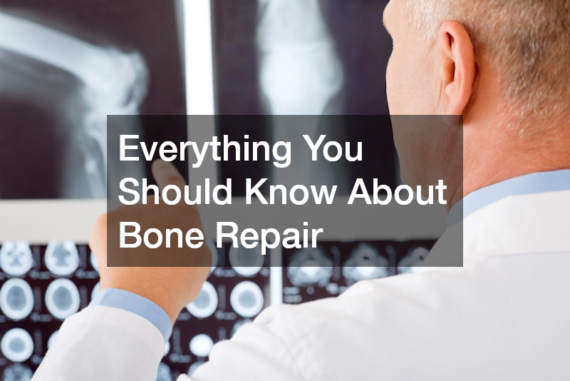 Everything You Should Know About Bone Repair